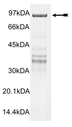 Eurofins DiscoverX CHK2 (R145W) Protein, Active 250 &mu;g | Buy Online | Eurofins DiscoverX | Fisher Scientific